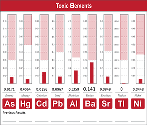 Toxic Elements